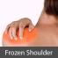 Low Cost Frozen Shoulder Treatment in india