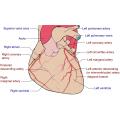 Types Of Coronary Arteries Bypass Grafting Surgery In India 