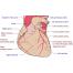 Types Of Coronary Arteries Bypass Grafting Surgery In India 
