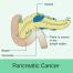 Treatment for Pancreatic Cancer in India at the most economical costs