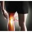 Choose the Right Knee Implants for your Knee Replacement Surgery