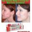 Prescription free acne treatment with buy retin a cream